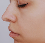 تصویر قبل از درمان